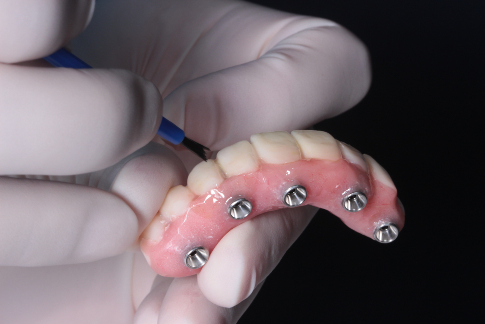 All on 4植牙手術推薦東區牙醫耀美診所